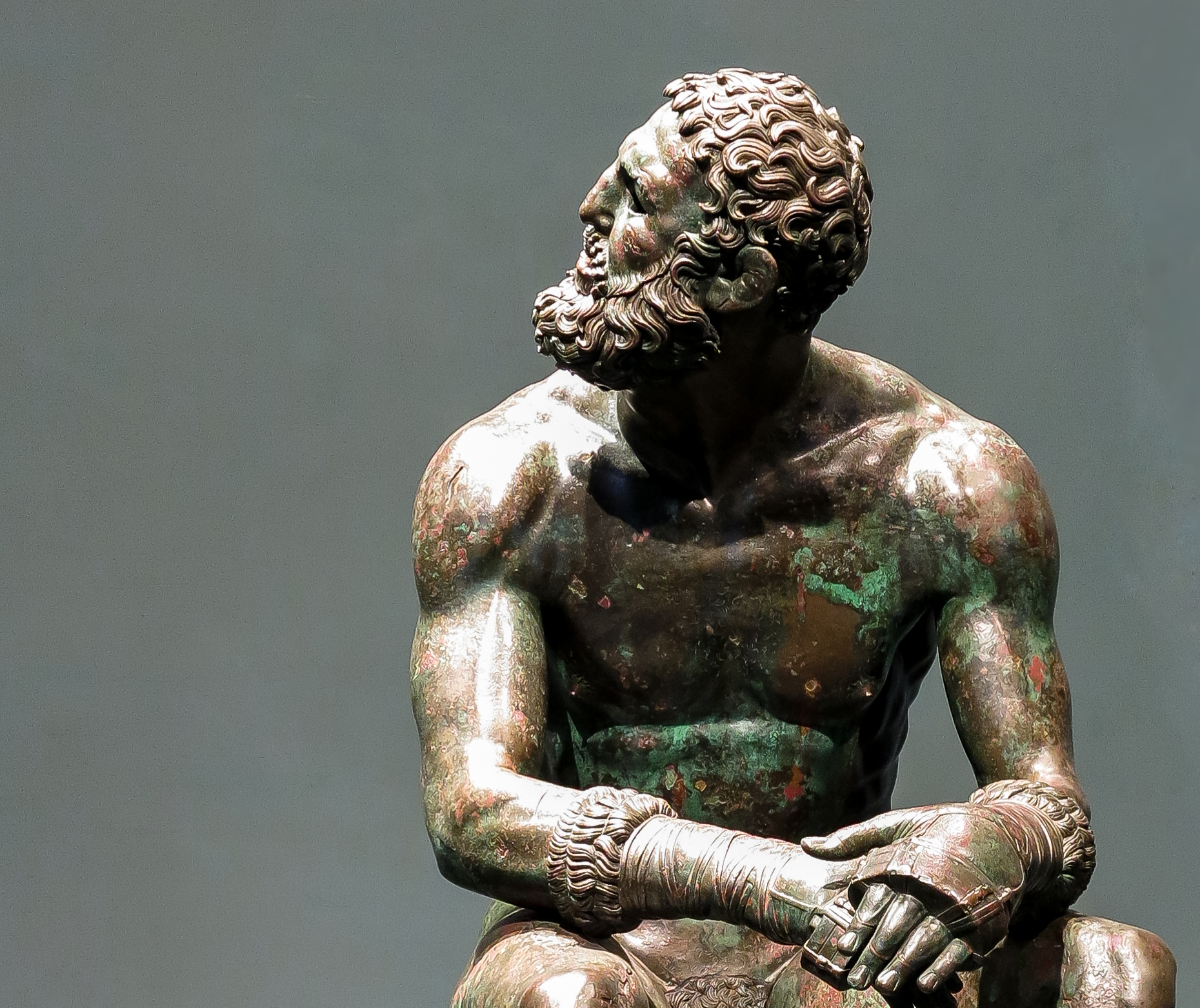 Retired boxer (4th century BC Greece)...